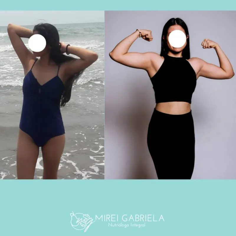 Antes y después de una paciente de Mirei